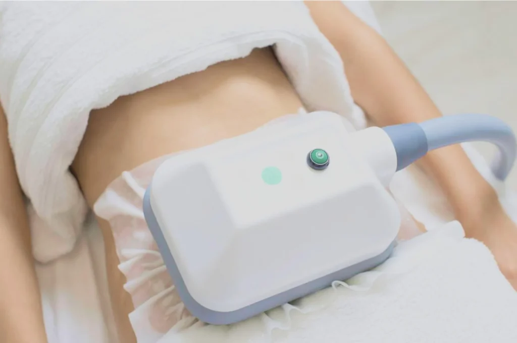 How Fat Freezing and HIFU Work Together? 3 advantages to combining Fat Freezing and HIFU Eastbourne