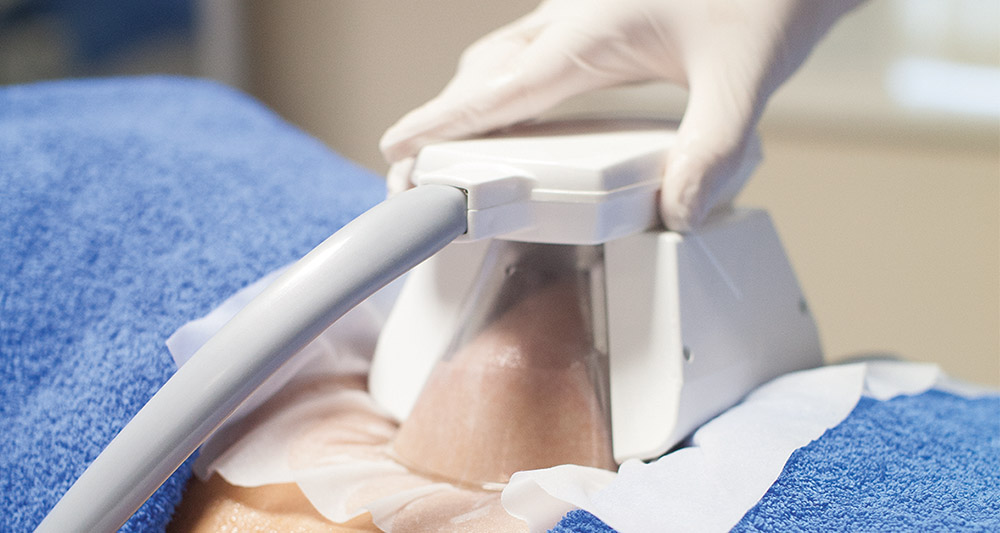 How Fat Freezing and HIFU Work Together? 2 Multiple Areas in One Session HIFU and Fat Freezing Eastbourne