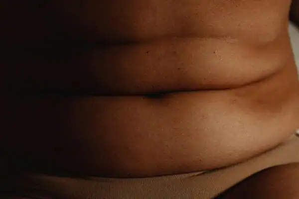 The Hidden Connection: How Stress Shapes Your Fitness and Body Composition 3 image of what stress can do on the stomach area and how Lipo 360 Eastbourne can help to change your body shape.