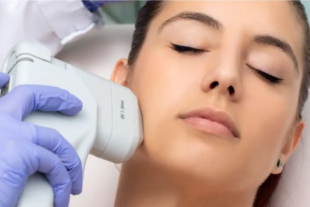 Discover the Perfect Duo: RF Microneedling and HIFU 2 Image of Morpheus8 And HIFU Combined with Lipo 360 Eastbourne